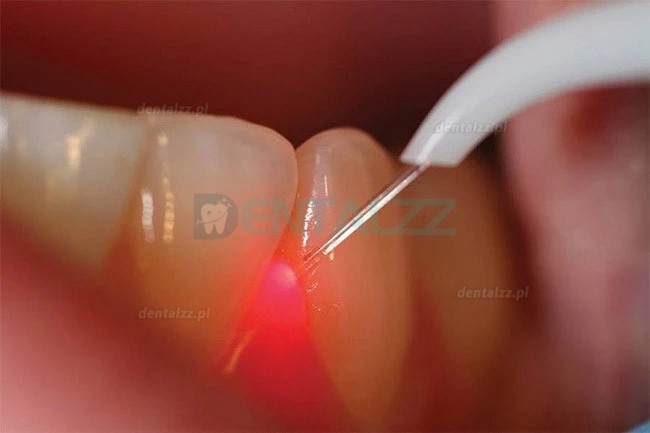 Gigaa maszyna laserowa do tkanek miękkich CHEESE Link Mini dentystyczny laser diodowy 7W-10W 810/980nm